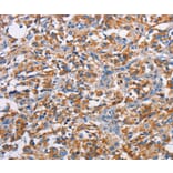 Immunohistochemistry - PIM2 Antibody from Signalway Antibody (36203) - Antibodies.com