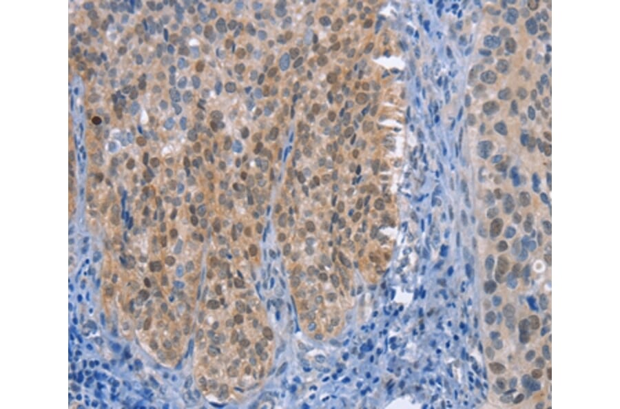 Immunohistochemistry - UCK1 Antibody from Signalway Antibody (36209) - Antibodies.com