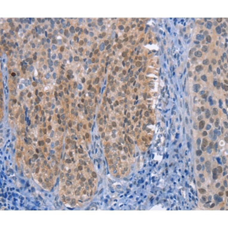 Immunohistochemistry - UCK1 Antibody from Signalway Antibody (36209) - Antibodies.com