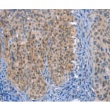 Immunohistochemistry - UCK1 Antibody from Signalway Antibody (36209) - Antibodies.com
