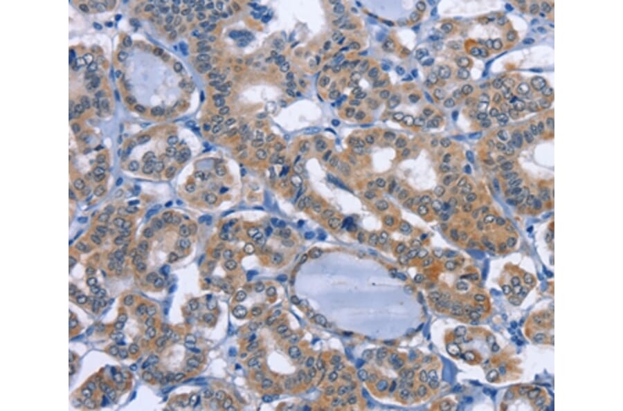 Immunohistochemistry - UCK1 Antibody from Signalway Antibody (36209) - Antibodies.com