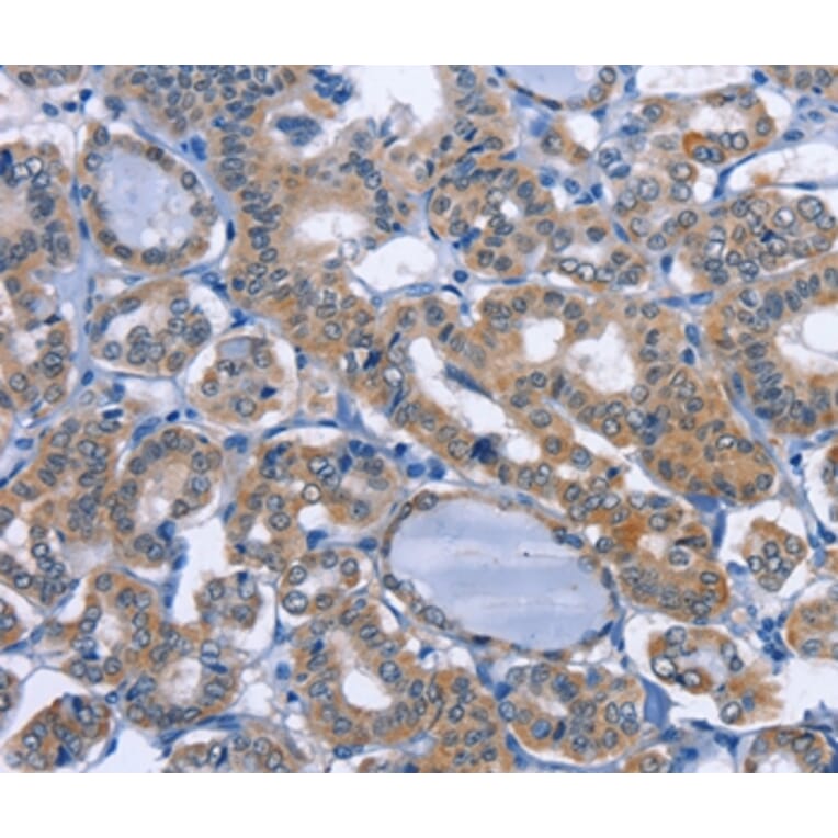 Immunohistochemistry - UCK1 Antibody from Signalway Antibody (36209) - Antibodies.com