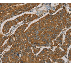 Immunohistochemistry - NPPB Antibody from Signalway Antibody (36213) - Antibodies.com