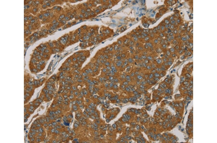 Immunohistochemistry - NPPB Antibody from Signalway Antibody (36213) - Antibodies.com