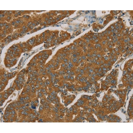 Immunohistochemistry - NPPB Antibody from Signalway Antibody (36213) - Antibodies.com