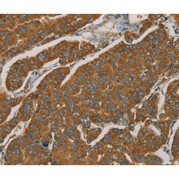 Immunohistochemistry - NPPB Antibody from Signalway Antibody (36213) - Antibodies.com