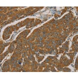 Immunohistochemistry - NPPB Antibody from Signalway Antibody (36213) - Antibodies.com