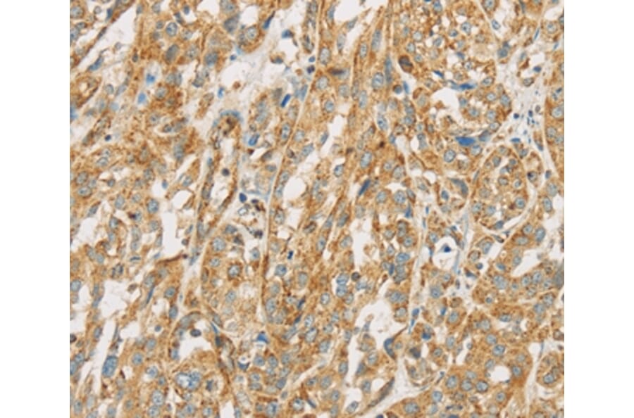 Immunohistochemistry - NPPB Antibody from Signalway Antibody (36213) - Antibodies.com
