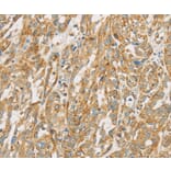 Immunohistochemistry - NPPB Antibody from Signalway Antibody (36213) - Antibodies.com