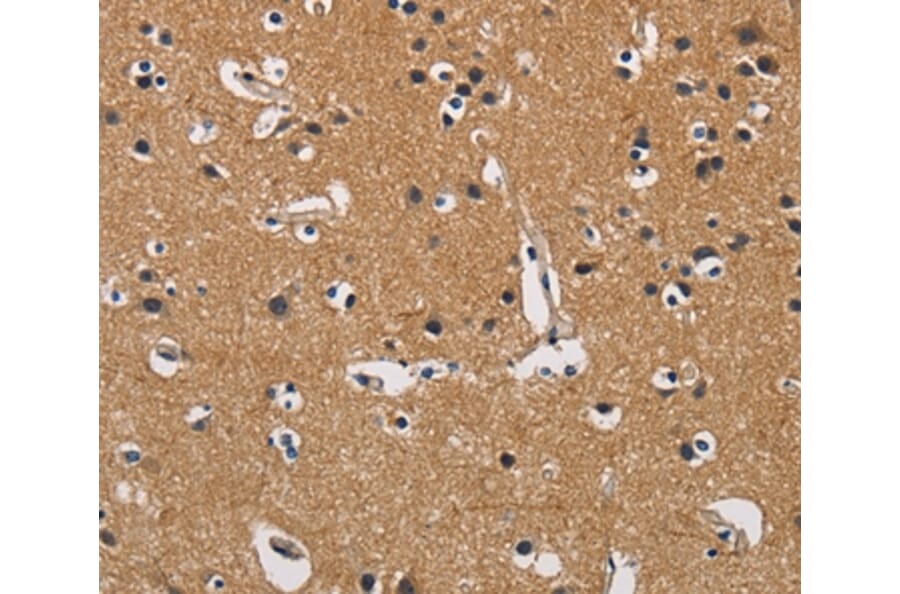 Immunohistochemistry - CBY1 Antibody from Signalway Antibody (36217) - Antibodies.com