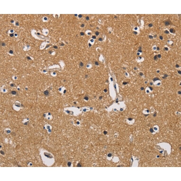 Immunohistochemistry - CBY1 Antibody from Signalway Antibody (36217) - Antibodies.com