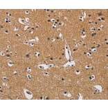 Immunohistochemistry - CBY1 Antibody from Signalway Antibody (36217) - Antibodies.com