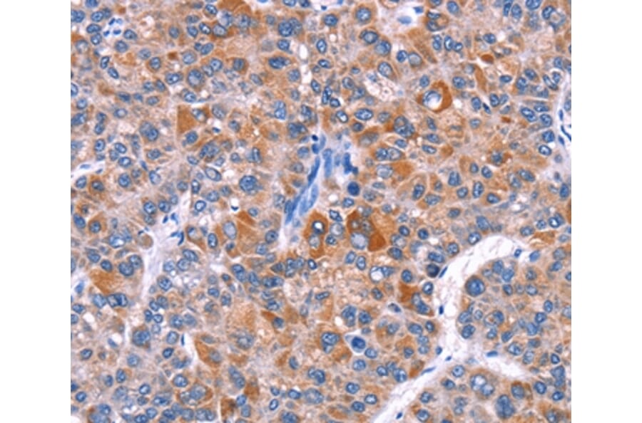 Immunohistochemistry - ELP2 Antibody from Signalway Antibody (36223) - Antibodies.com