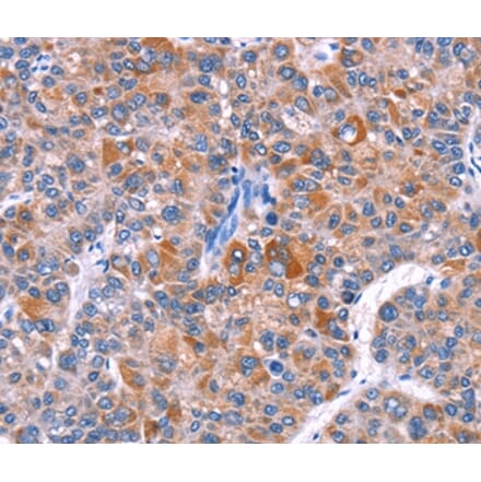 Immunohistochemistry - ELP2 Antibody from Signalway Antibody (36223) - Antibodies.com