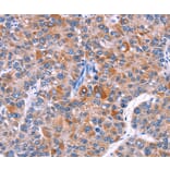 Immunohistochemistry - ELP2 Antibody from Signalway Antibody (36223) - Antibodies.com