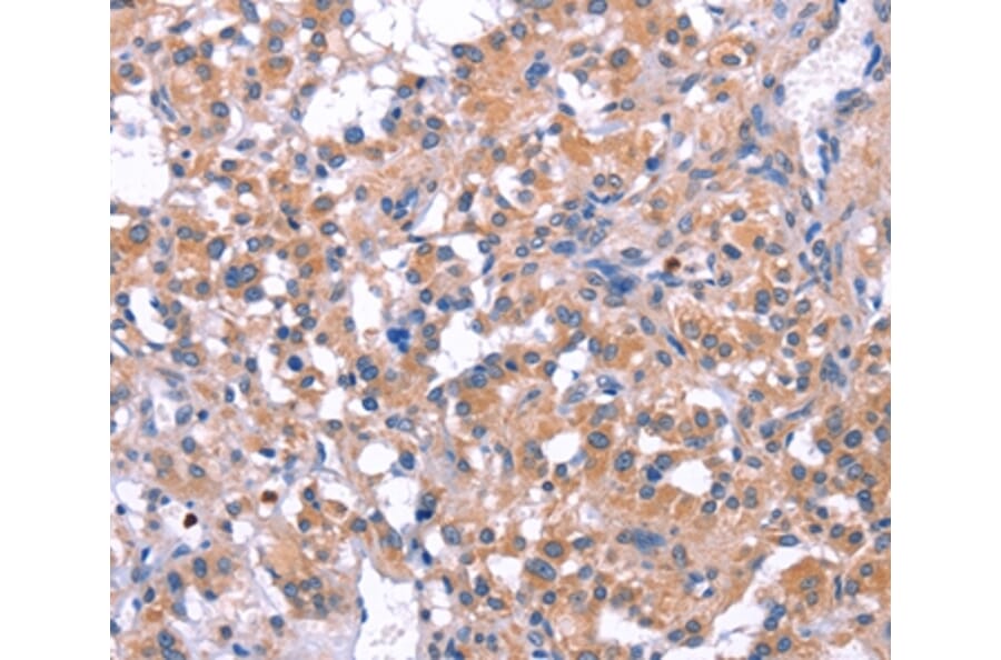 Immunohistochemistry - ELP2 Antibody from Signalway Antibody (36223) - Antibodies.com
