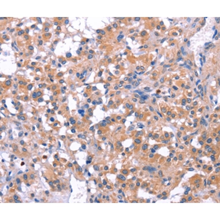 Immunohistochemistry - ELP2 Antibody from Signalway Antibody (36223) - Antibodies.com