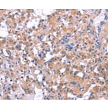 Immunohistochemistry - ELP2 Antibody from Signalway Antibody (36223) - Antibodies.com