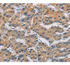 Immunohistochemistry - CERK Antibody from Signalway Antibody (36237) - Antibodies.com