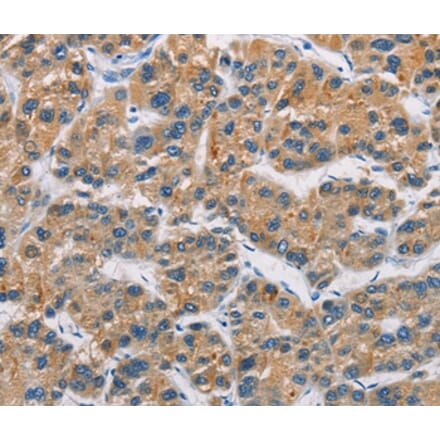 Immunohistochemistry - CERK Antibody from Signalway Antibody (36237) - Antibodies.com