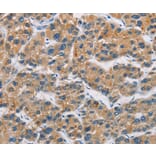 Immunohistochemistry - CERK Antibody from Signalway Antibody (36237) - Antibodies.com