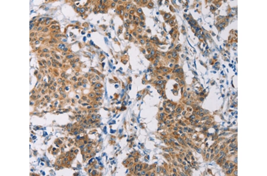 Immunohistochemistry - CERK Antibody from Signalway Antibody (36237) - Antibodies.com