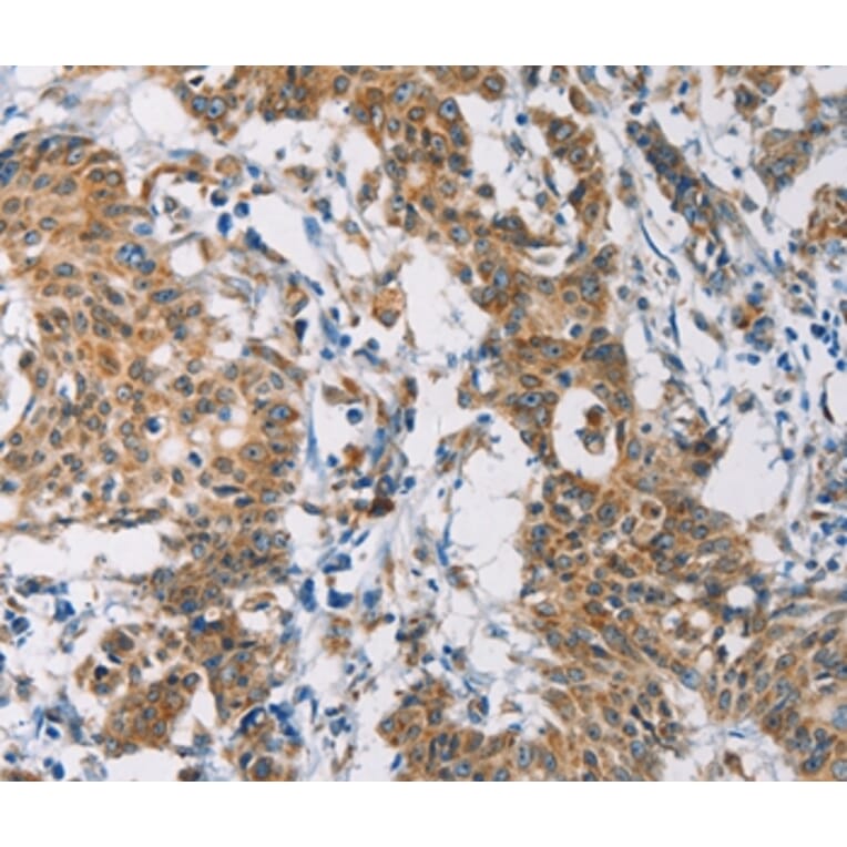 Immunohistochemistry - CERK Antibody from Signalway Antibody (36237) - Antibodies.com