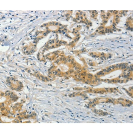 Immunohistochemistry - ASB8 Antibody from Signalway Antibody (36241) - Antibodies.com