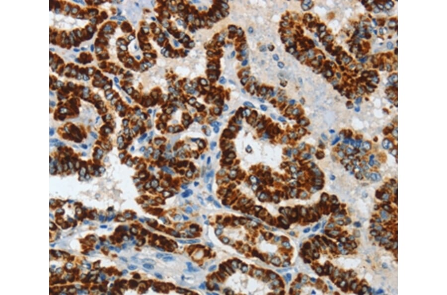 Immunohistochemistry - ASB4 Antibody from Signalway Antibody (36242) - Antibodies.com