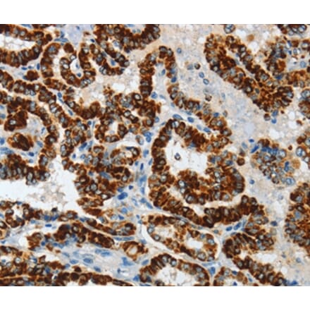 Immunohistochemistry - ASB4 Antibody from Signalway Antibody (36242) - Antibodies.com