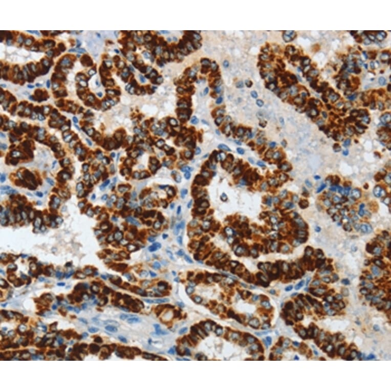 Immunohistochemistry - ASB4 Antibody from Signalway Antibody (36242) - Antibodies.com
