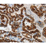 Immunohistochemistry - ASB4 Antibody from Signalway Antibody (36242) - Antibodies.com