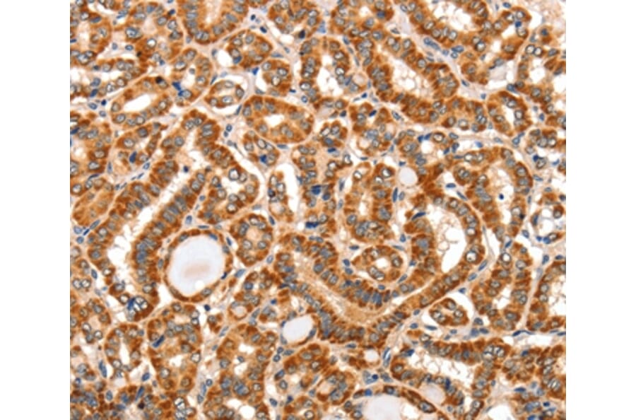Immunohistochemistry - AIM2 Antibody from Signalway Antibody (36253) - Antibodies.com