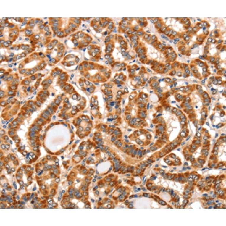 Immunohistochemistry - AIM2 Antibody from Signalway Antibody (36253) - Antibodies.com