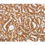 Immunohistochemistry - AIM2 Antibody from Signalway Antibody (36253) - Antibodies.com