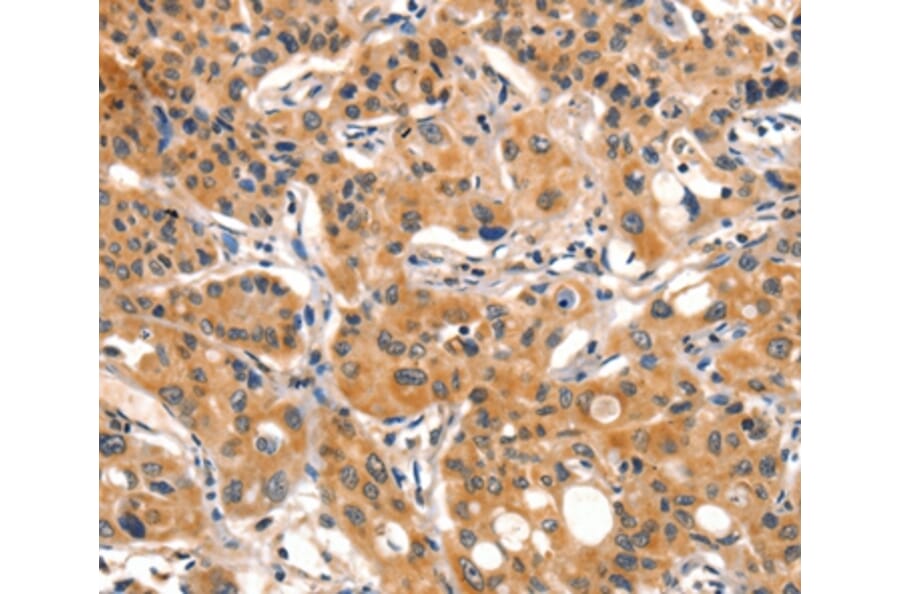 Immunohistochemistry - AIM2 Antibody from Signalway Antibody (36253) - Antibodies.com
