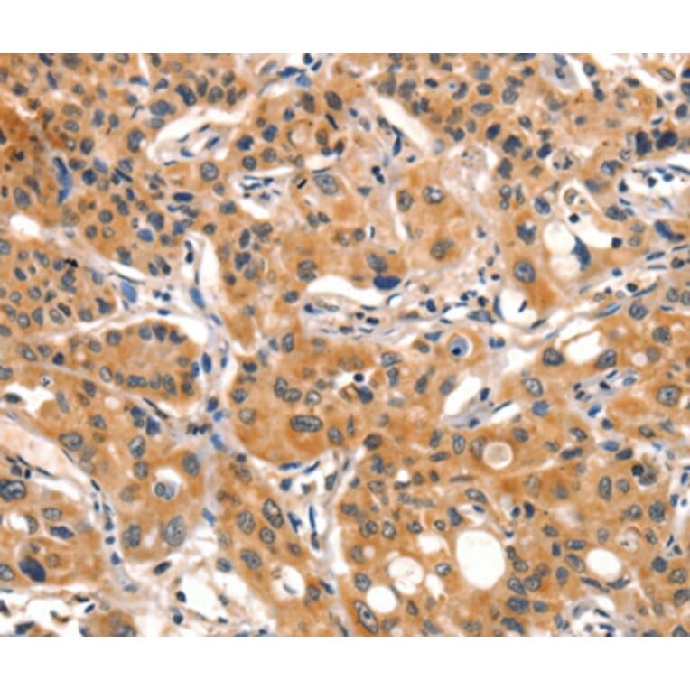 Immunohistochemistry - AIM2 Antibody from Signalway Antibody (36253) - Antibodies.com