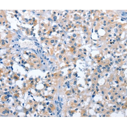 Immunohistochemistry - ASB2 Antibody from Signalway Antibody (36263) - Antibodies.com