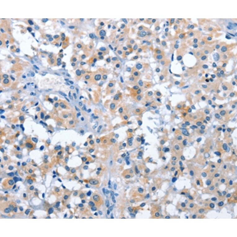 Immunohistochemistry - ASB2 Antibody from Signalway Antibody (36263) - Antibodies.com