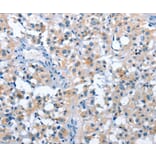 Immunohistochemistry - ASB2 Antibody from Signalway Antibody (36263) - Antibodies.com