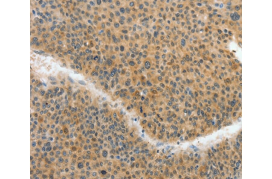 Immunohistochemistry - ACLY Antibody from Signalway Antibody (36267) - Antibodies.com