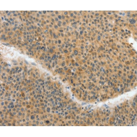 Immunohistochemistry - ACLY Antibody from Signalway Antibody (36267) - Antibodies.com