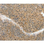 Immunohistochemistry - ACLY Antibody from Signalway Antibody (36267) - Antibodies.com