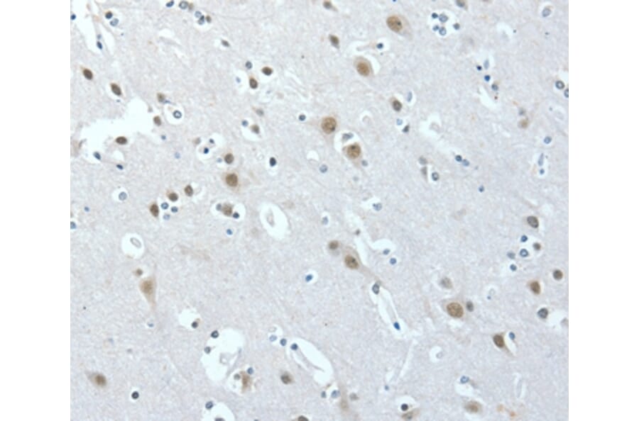Immunohistochemistry - ACLY Antibody from Signalway Antibody (36267) - Antibodies.com