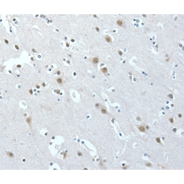 Immunohistochemistry - ACLY Antibody from Signalway Antibody (36267) - Antibodies.com