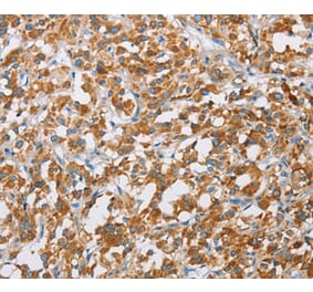 Immunohistochemistry - BDH1 Antibody from Signalway Antibody (36279) - Antibodies.com