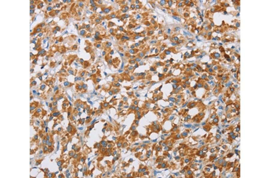 Immunohistochemistry - BDH1 Antibody from Signalway Antibody (36279) - Antibodies.com