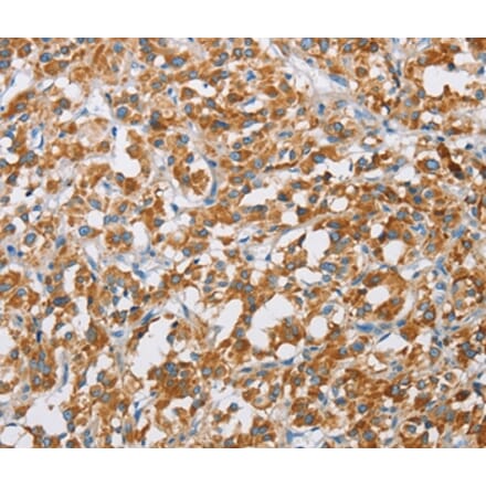Immunohistochemistry - BDH1 Antibody from Signalway Antibody (36279) - Antibodies.com