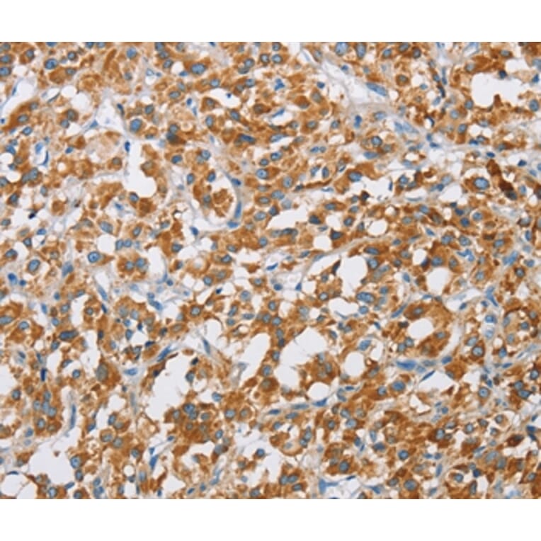 Immunohistochemistry - BDH1 Antibody from Signalway Antibody (36279) - Antibodies.com