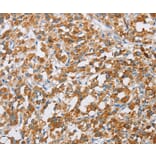 Immunohistochemistry - BDH1 Antibody from Signalway Antibody (36279) - Antibodies.com